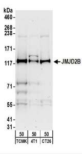 KDM4B / JMJD2B Antibody - Detection of Mouse JMJD2B by Western Blot. Samples: Whole cell lysate (50 ug) from TCMK-1, 4T1, and CT26.WT cells. Antibodies: Affinity purified rabbit anti-JMJD2B antibody used for WB at 0.5 ug/ml. Detection: Chemiluminescence with an exposure time of 30 seconds.