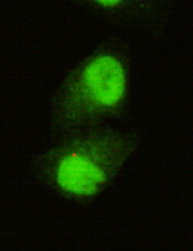 KDM5C / Jarid1C / SMCX Antibody - Immunocytochemistry of HeLa cells using anti- KDM5C (C-terminus) antibody diluted 1:150.