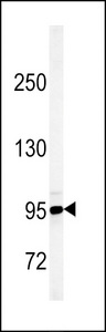 KDM7A / JHDM1D Antibody - Western blot of JHDM1D Antibody in 293 cell line lysates (35 ug/lane). JHDM1D (arrow) was detected using the purified antibody.