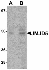 KDM8 / JMJD5 / FLJ13798 Antibody - Western blot of JMJD5 in human liver tissue lysate with JMJD5 antibody at (A) 1 and (B) 2 ug/ml. 