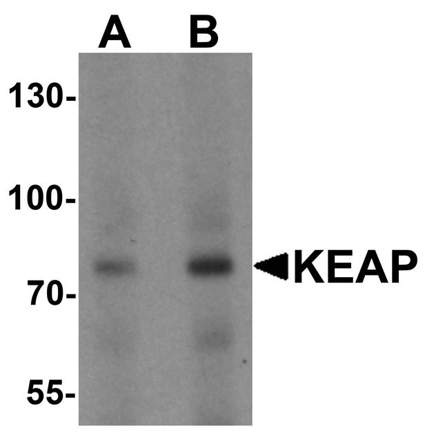 KEAP1 Antibody - Western blot analysis of KEAP1 in human lung tissue lysate with KEAP1 antibody at (A) 1 and (B) 2 ug/ml.