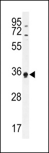 KHDC3L / ECAT1 Antibody - ECAT1 Antibody western blot of HL-60 cell line lysates (35 ug/lane). The ECAT1 antibody detected the ECAT1 protein (arrow).