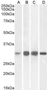 KHK / Ketohexokinase Antibody - KHK / Ketohexokinase antibody (0.03µg/ml) staining of Human (A), Mouse (B), Rat (C) and Pig (D) Liver lysates (35µg protein in RIPA buffer). Detected by chemiluminescence.