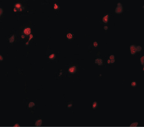 KIAA0141 Antibody - Immunofluorescence of DELE in human brain tissue with DELE antibody at 20 ug/ml.