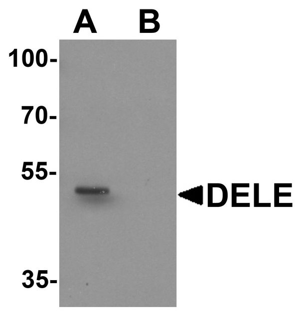 KIAA0141 Antibody - Western blot analysis of DELE in rat brain tissue lysate with DELE antibody at 1 ug/ml in (A) the absence and (B) the presence of blocking peptide.