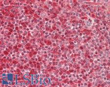 KIAA0391 Antibody - Human Spleen: Formalin-Fixed, Paraffin-Embedded (FFPE)