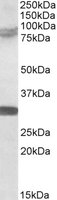 KIAA0517 / TRIM2 Antibody - TRIM2 antibody (0.5 ug/ml) staining of Rat Brain lysate (35 ug protein/ml in RIPA buffer). Primary incubation was 1 hour. Detected by chemiluminescence.