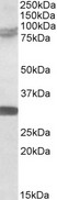 KIAA0517 / TRIM2 Antibody - KIAA0517 / TRIM2 antibody (0.5µg/ml) staining of Rat Brain lysate (35µg protein in RIPA buffer). Detected by chemiluminescence.
