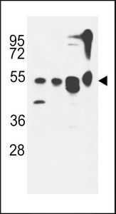 KIAA0652 / ATG13 Antibody - ATG13 Antibody western blot of MDA-MB435,CEM,T47D cell line and mouse cerebellum tissue lysates (35 ug/lane). The ATG13 antibody detected the ATG13 protein (arrow).