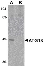 KIAA0652 / ATG13 Antibody - Western blot of rat heart tissue lysate probed with Rabbit anti-Mouse ATG13 at 1uM in the absence (A) or presence (B) of blocking peptide
