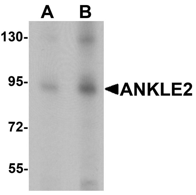 KIAA0692 / ANKLE2 Antibody - Western blot analysis of ANKLE2 in SW480 cell lysate with ANKLE2 antibody at (A) 1 and (B) 2 ug/ml.