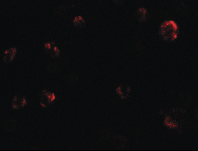 KIAA1324 / maba1 Antibody - Immunofluorescence of EIG121 in MCF7 cells with EIG121 antibody at 20 ug/ml.