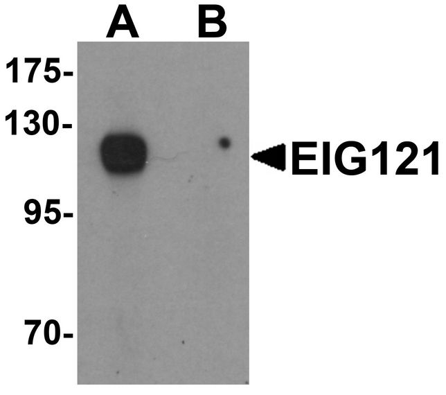 KIAA1324 / maba1 Antibody - Western blot analysis of EIG121 in MCF7 cell lysate with EIG121 antibody at 1 ug/ml in (A) the absence and (B) the presence of blocking peptide.