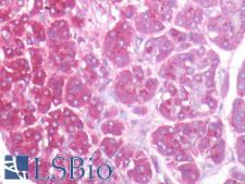 KIAA1324 / maba1 Antibody - Human Pancreas: Formalin-Fixed, Paraffin-Embedded (FFPE)
