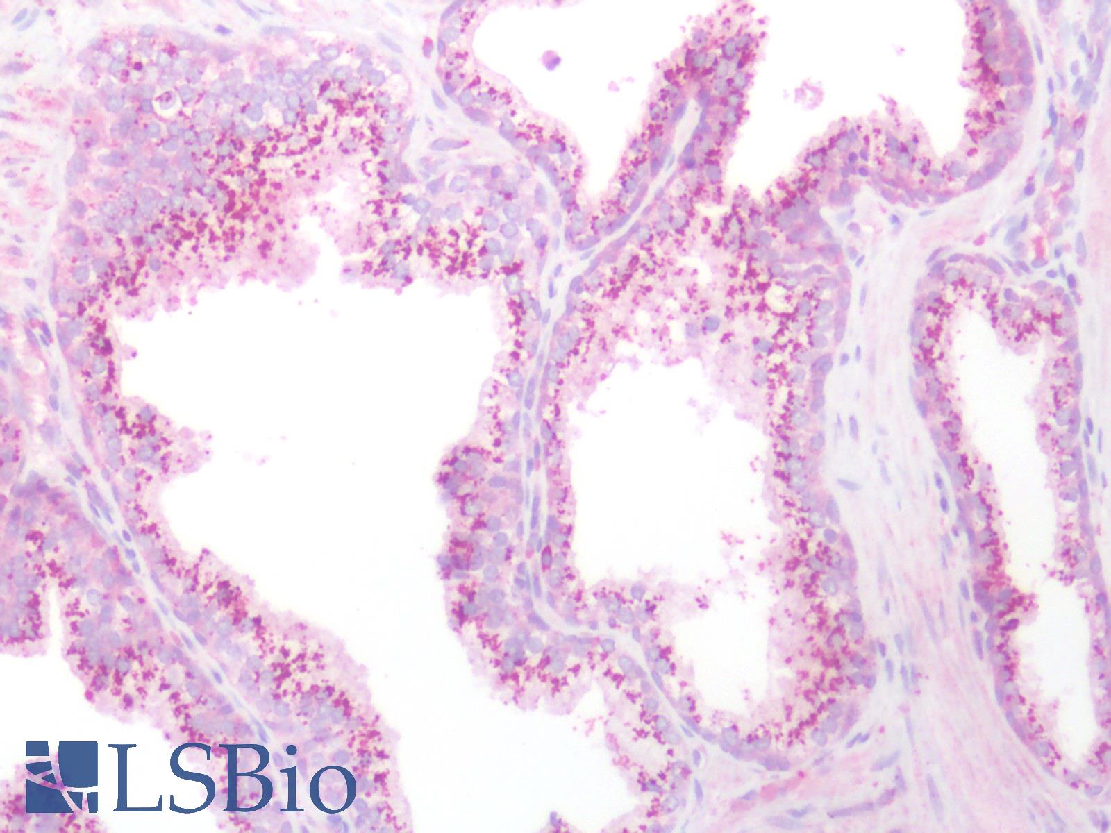 KIAA1324 / maba1 Antibody - Human Prostate: Formalin-Fixed, Paraffin-Embedded (FFPE)