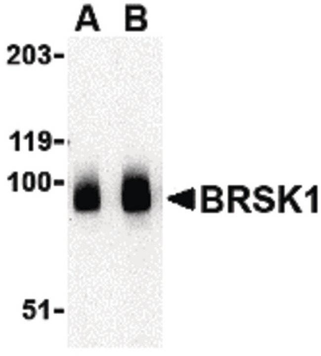 KIAA1811 / BRSK1 Antibody - Western blot of BRSK1 in human brain tissue lysate with BRSK1 antibody at (A) 0.5 and (B) 1 ug/ml.