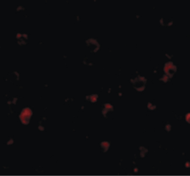 KIAA1811 / BRSK1 Antibody - Immunofluorescence of BRSK1 in Human Brain cells with BRSK1 antibody at 20 ug/ml.