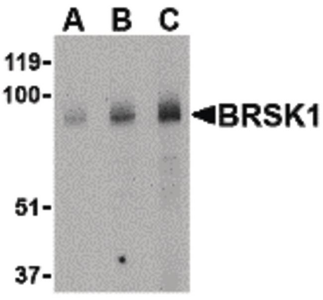 KIAA1811 / BRSK1 Antibody - Western blot of BRSK1 in human brain tissue lysate with BRSK1 antibody at (A) 0.5, (B) 1 and (C) 2 ug/ml.