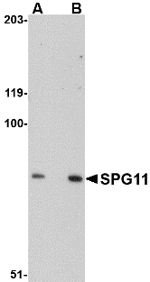 KIAA1840 / SPG11 Antibody - Western blot of SPG11 in mouse heart tissue lysate with SPG11 antibody at (A) 0.5 and (B) 1 ug/ml.