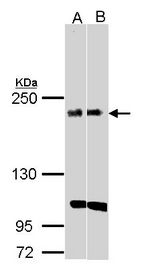 KIDINS220 / ARMS Antibody - Sample (30 ug whole cell lysate). A: H1299, B: Raji . 5% SDS PAGE. KIDINS220 / ARMS antibody diluted at 1:1000