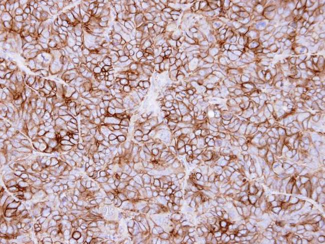 KIDINS220 / ARMS Antibody - IHC of paraffin-embedded SW480 xenograft using KIDINS220 antibody at 1:500 dilution.