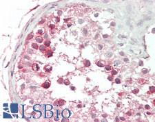 KIF11 / EG5 Antibody - Human Testis: Formalin-Fixed, Paraffin-Embedded (FFPE)