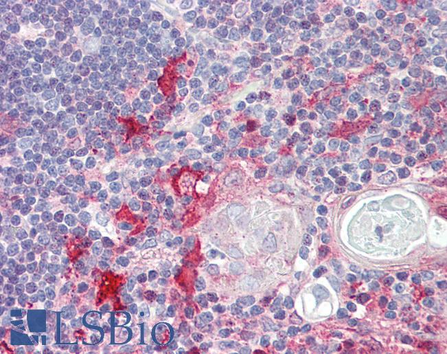 KIF13B / GAKIN Antibody - Anti-KIF13B / GAKIN antibody IHC of human thymus. Immunohistochemistry of formalin-fixed, paraffin-embedded tissue after heat-induced antigen retrieval. Antibody dilution 5 ug/ml.