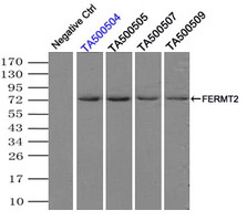 KIND2 / FERMT2 Antibody - Immunoprecipitation(IP) of FERMT2 by using monoclonal anti-FERMT2 antibodies (Negative control: IP without adding anti-FERMT2 antibody.). For each experiment, 500ul of DDK tagged FERMT2 overexpression lysates (at 1:5 dilution with HEK293T lysate), 2 ug of anti-FERMT2 antibody and 20ul (0.1 mg) of goat anti-mouse conjugated magnetic beads were mixed and incubated overnight. After extensive wash to remove any non-specific binding, the immuno-precipitated products were analyzed with rabbit anti-DDK polyclonal antibody.
