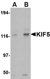 Kinesin 5A / KIF5A Antibody - Western blot of KIF5 in K562 cell lysate with KIF5 antibody at (A) 0.5 and (B) 1 ug/ml.