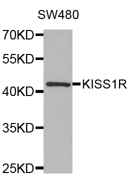 KISS1R / GPR54 Antibody - Western blot analysis of extracts of SW480 cells.