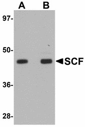 KITLG / SCF Antibody - Western blot of SCF in rat brain tissue lysate with SCF antibody at (A) 1 and (B) 2 ug/ml. 