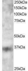 KLF16 Antibody - Antibody staining (3 ug/ml) of 293 lysate (RIPA buffer, 30 ug total protein per lane). Primary incubated for 12 hour. Detected by Western blot of chemiluminescence.