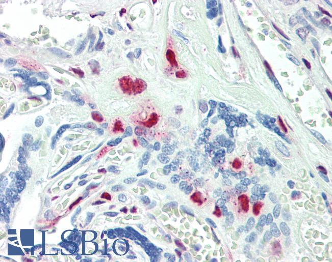 KLF16 Antibody - Anti-KLF16 antibody IHC staining of human placenta. Immunohistochemistry of formalin-fixed, paraffin-embedded tissue after heat-induced antigen retrieval. Antibody concentration 5 ug/ml.