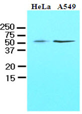 KLF4 Antibody - Cell lysates of HeLa and A549 (40 ug) were resolved by SDS-PAGE, transferred to NC membrane and probed with anti-human KLF4 (1:1000). Proteins were visualized using a goat anti-mouse secondary antibody conjugated to HRP and an ECL detection system.