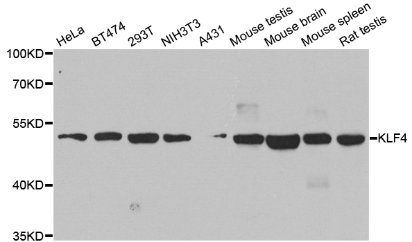 KLF4 Antibody - Western blot blot of extracts of various cell lines, using KLF4 antibody.