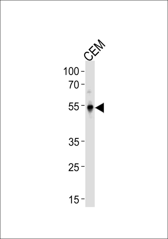 KLF5 / BTEB2 Antibody - KLF5 Antibody western blot of CEM cell line lysates (35 ug/lane). The KLF5 antibody detected the KLF5 protein (arrow).