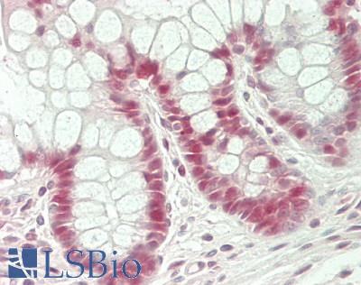 KLF5 / BTEB2 Antibody - Human Small Intestine: Formalin-Fixed, Paraffin-Embedded (FFPE)