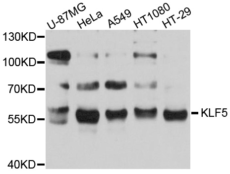 KLF5 / BTEB2 Antibody - Western blot analysis using KLF5 antibody.