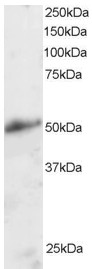 KLF8 Antibody - Staining (2 ug/ml) of Human Kidney lysate (RIPA buffer, 30 ug total protein per lane). Primary incubated for 1 hour. Detected by chemiluminescence.