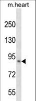 KLHL1 Antibody - KLHL1 Antibody western blot of mouse heart tissue lysates (35 ug/lane). The KLHL1 antibody detected the KLHL1 protein (arrow).