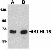 KLHL15 Antibody - Western blot of KLHL15 in HeLa cell lysate with KLHL15 antibody at (A) 1 and (B) 2 ug/ml. 