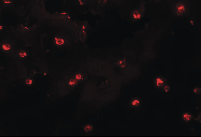 KLHL25 Antibody - Immunofluorescence of ENC-2 in Jurkat cells with ENC-2 antibody at 20 ug/ml.