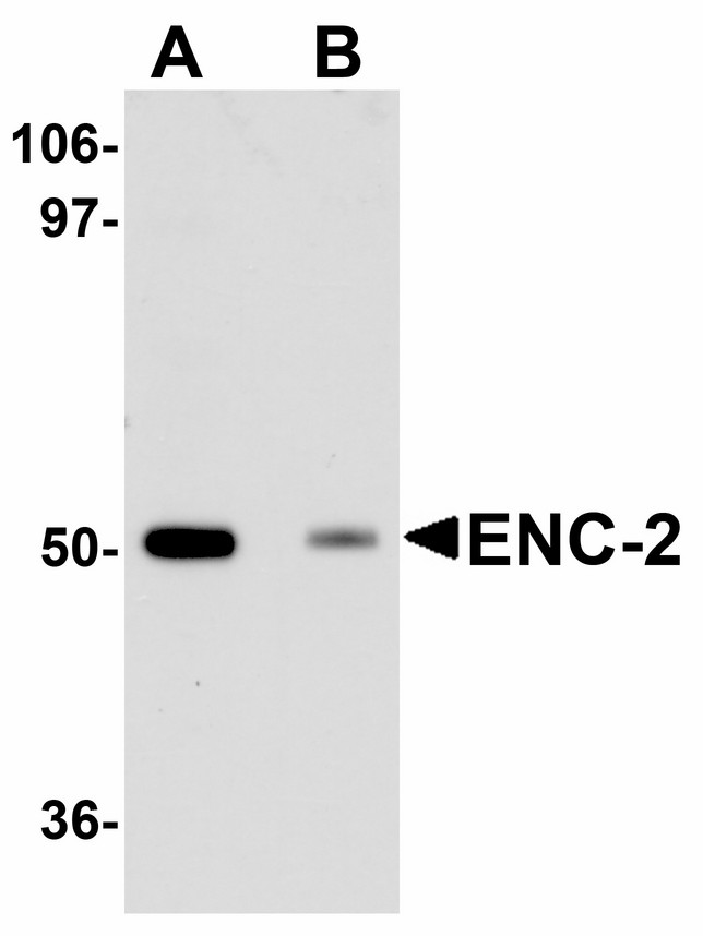 KLHL25 Antibody - Western blot of ENC-2 in Jurkat cell lysate with ENC-2 antibody at 1 ug/ml in (A) the absence and (B) the presence of blocking peptide.