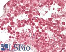 KLHL28 / BTBD5 Antibody - Human Testis: Formalin-Fixed, Paraffin-Embedded (FFPE)