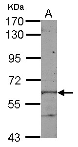 KLHL28 / BTBD5 Antibody - Sample (50 ug of whole cell lysate) A: mouse liver 7.5% SDS PAGE KLHL28 / BTBD5 antibody diluted at 1:1000