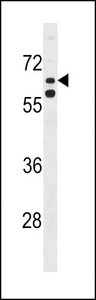 KLHL38 Antibody - KLHL38 Antibody western blot of HeLa cell line lysates (35 ug/lane). The KLHL38 antibody detected the KLHL38 protein (arrow).