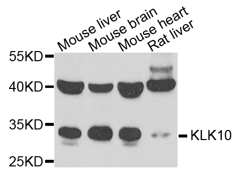 KLK10 / Kallikrein 10 Antibody - Western blot analysis of extracts of various cells.