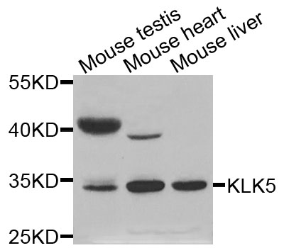 KLK5 / Kallikrein 5 Antibody - Western blot analysis of extracts of various cells.