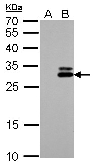 KLK7 / Kallikrein 7 Antibody - KLK7 antibody detects KLK7 protein by Western blot analysis. A. 30 ug 293T whole cell lysate/extract. B. 30 ug whole cell lysate/extract of human KLK7-transfected 293T cells. 12 % SDS-PAGE. KLK7 antibody dilution:1:5000