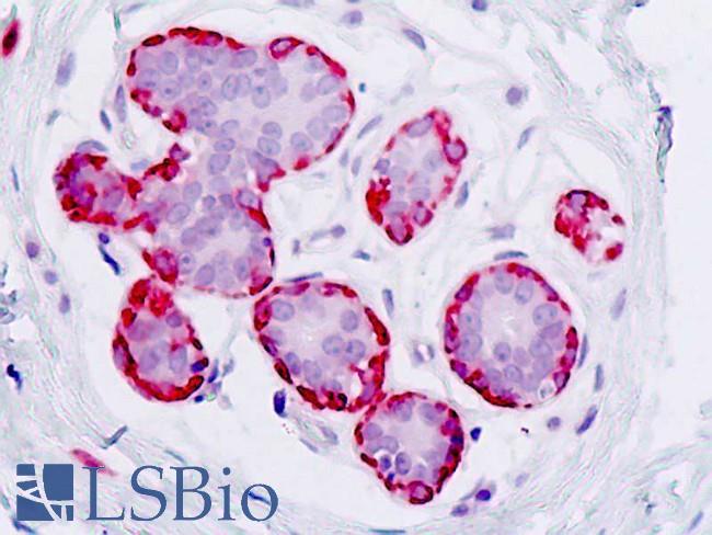KLKB1 / Plasma Kallikrein Antibody - Anti-KLKB1 / Plasma Kallikrein antibody IHC staining of human breast. Immunohistochemistry of formalin-fixed, paraffin-embedded tissue after heat-induced antigen retrieval.